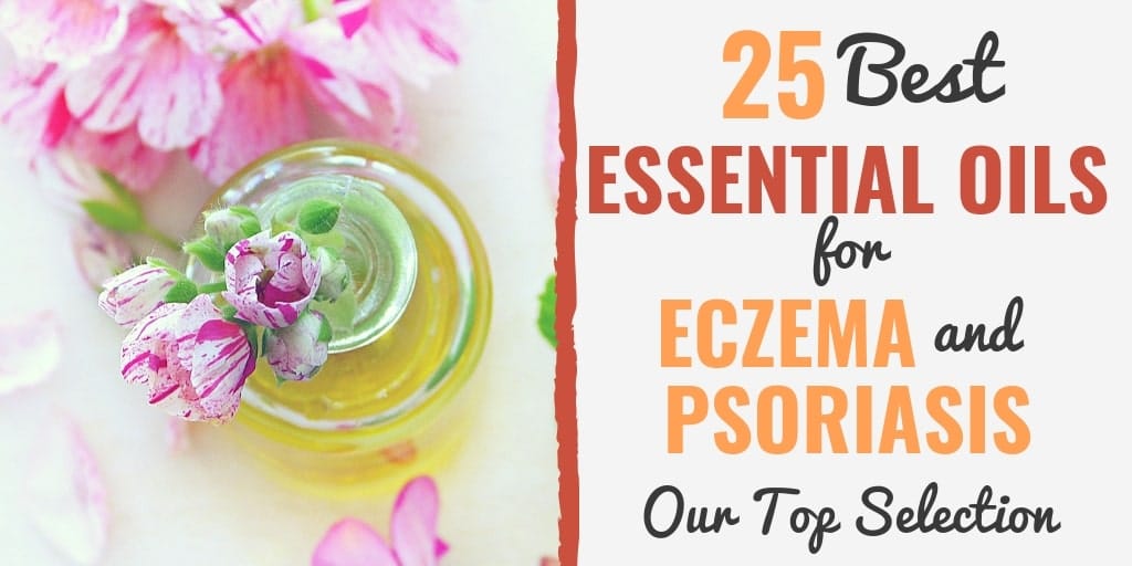 Essential Oils for Eczema & Psoriasis