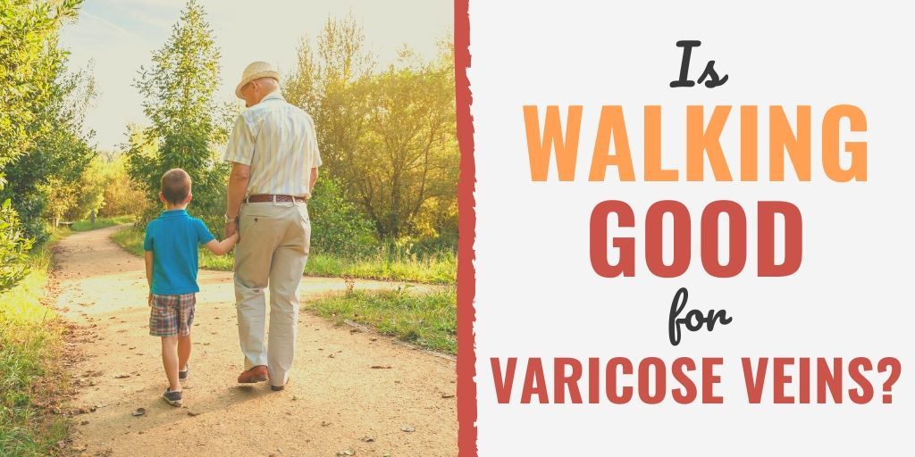 long walking varicoseza